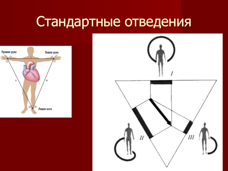 Правые отведения. Смежные стандартные отведения. Стандартное отведение это медицина. Что измеряют стандартные отведения. Функция переключателя отведений.