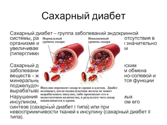 Сахарный диабет