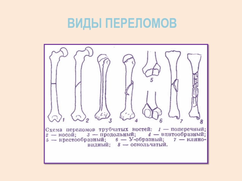 Схема длинной трубчатой кости взрослого человека и ребенка рентген