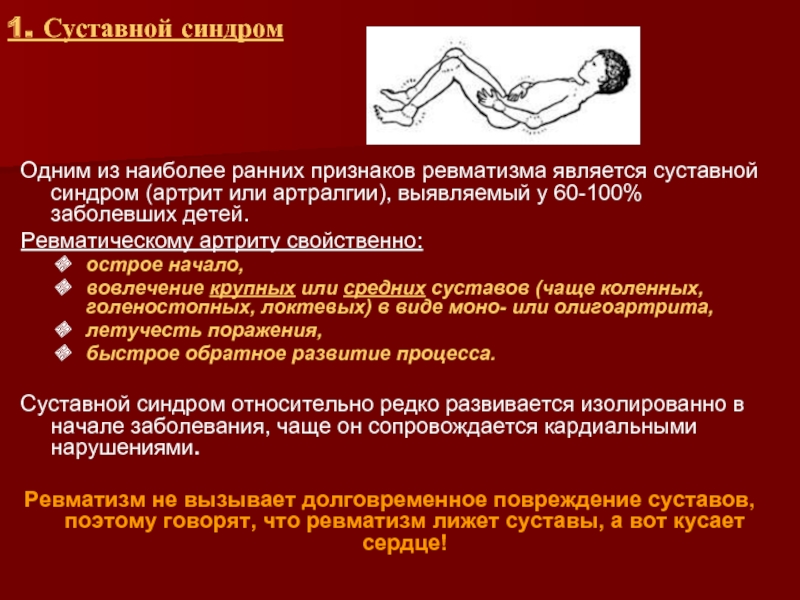 Суставной синдром у детей презентация