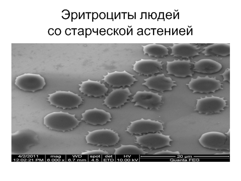 Эритроциты 22