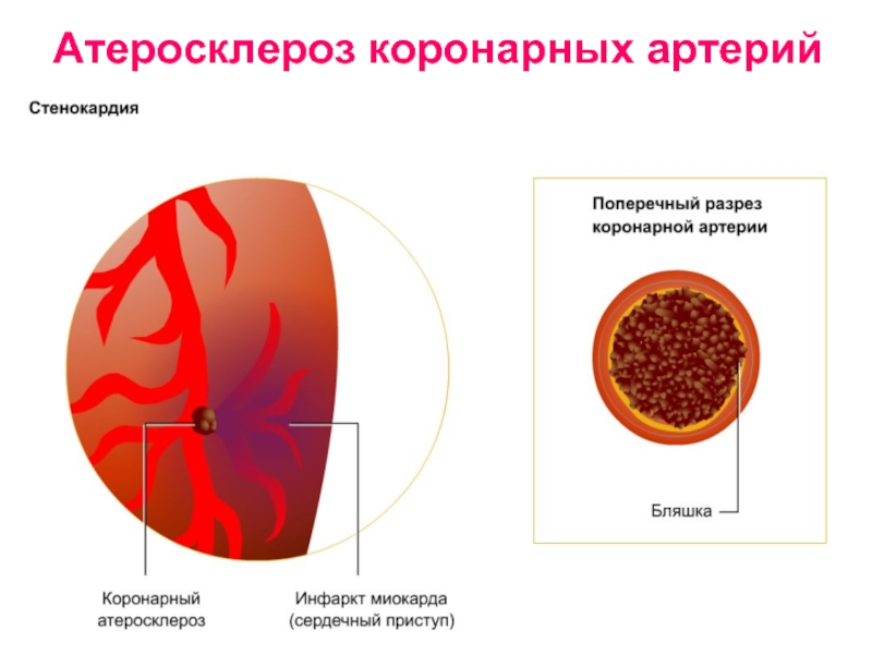 Расширением коронарных артерий тест