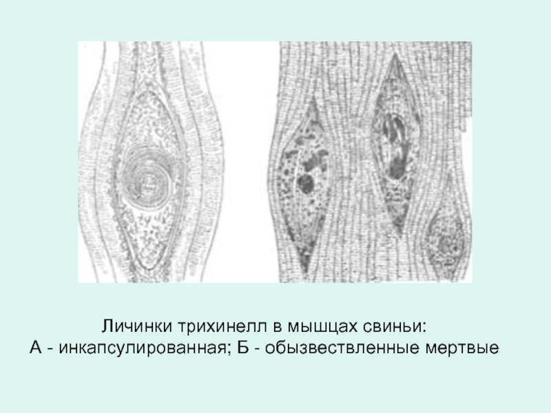 Рисунок трихинеллы в мышцах с обозначениями личинка