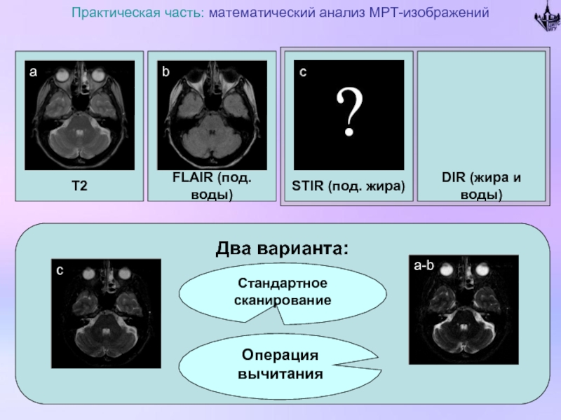 Анализ мрт. Мрт анализ. Режимы мрт диагностики. Режимы сканирования мрт. Сигналы мрт.