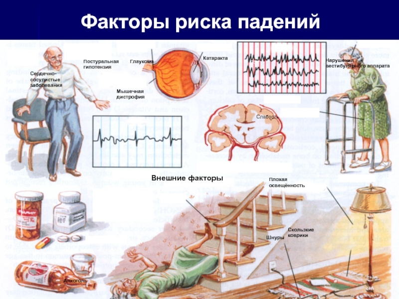 Профилактика падений пациентов в стационаре картинки