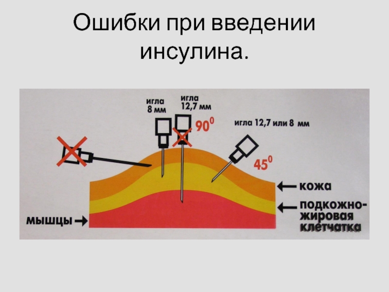 Фото как ставить инсулин