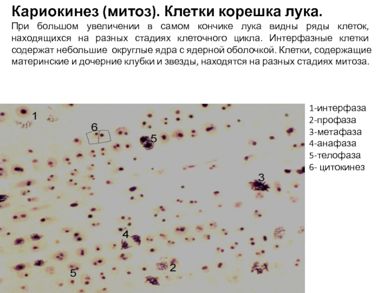 Ряд клеток. Кариокинез. Кариогенез это в биологии. Кариокинез это в биологии. Митоз кариокинез.