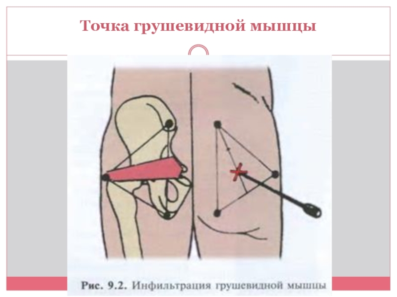 Схема грушевидной мышцы