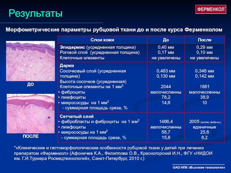 Изменения рубцовой ткани