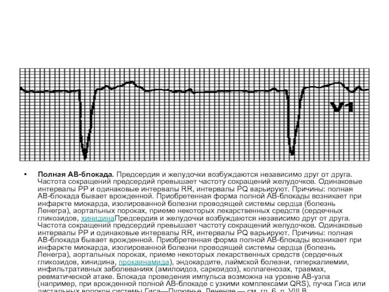 Одинаковый интервал. Частота желудочковых сокращений. Частота сокращения сердца и частота сокращения желудочков. Частота сокращения предсердий как считать. Пароксизм ФП И АВ блокада.