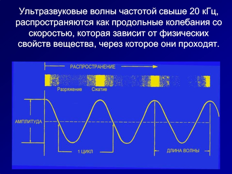 Наибольшую частоту волны имеет. Ультразвуковые колебания длины волн и частоты. Ультразвуковые волны физика свойства. Ультразвуковые волны частота.