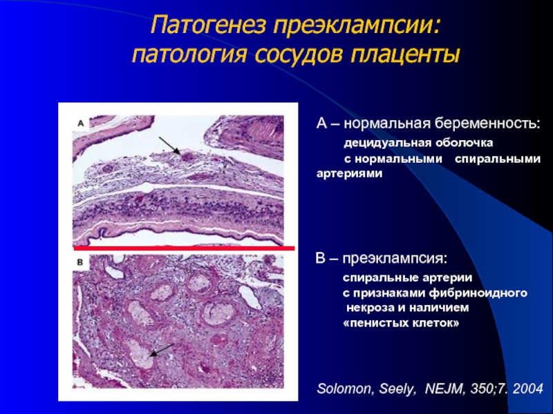 Плацента акушерство презентация