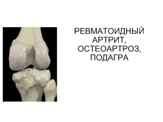 Ревматоидный артрит, остеоартроз, подагра