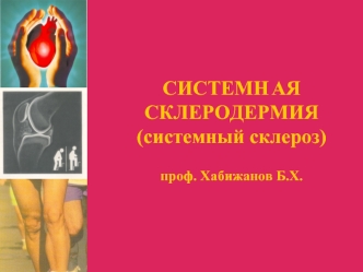 Системная склеродермия