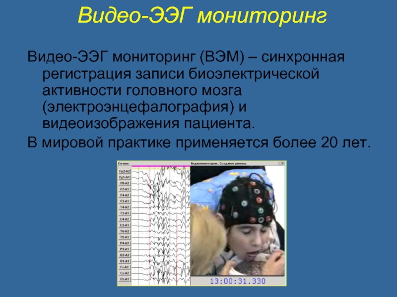 Биоэлектрическая активность головного мозга