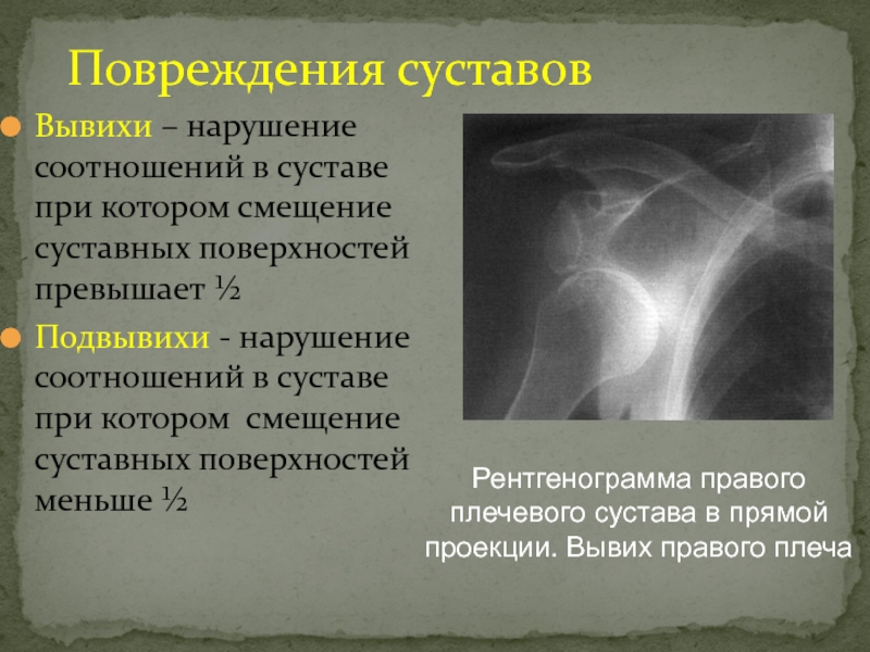 Рентгеновская картина переломов и вывихов костей