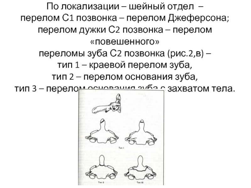 Перелом шейного позвонка. Перелом зуба 2 шейного позвонка. Перелом дужки шейного позвонка. Переломы зубовидного отростка классификация. Перелом 2 позвонка шейного отдела.