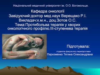 Особливості больового синдрому у хворих онкологічного профілю. Протибольова терапія