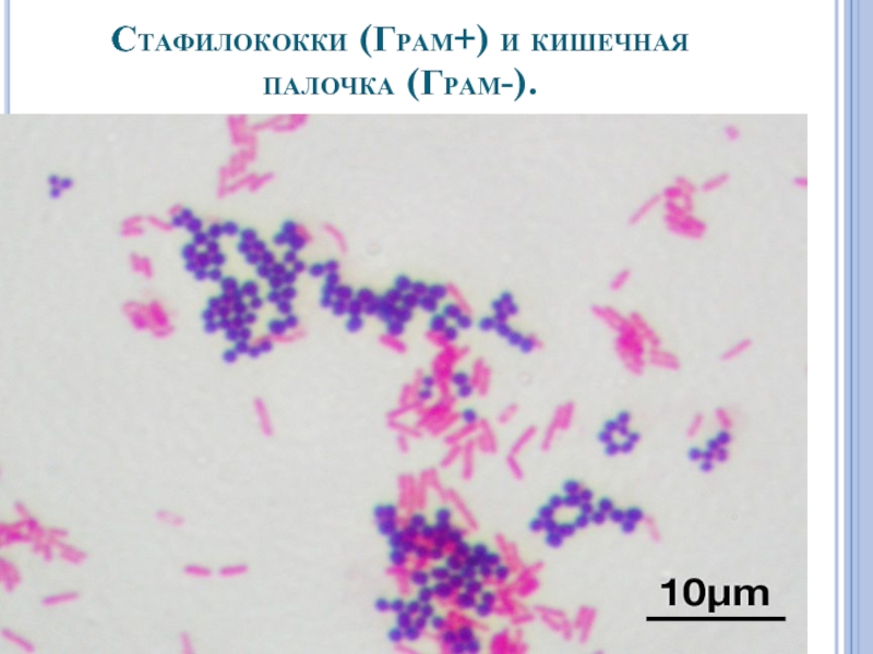 Грам. Грамотрицательные стафилококки. Грамположительные бактерии палочки. Палочки по Граму. Кишечная палочка стафилококк.