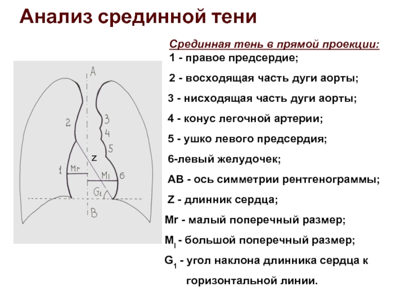 Проекция дуги. Дуга легочной артерии. Оценка срединной тени. Расположение срединной тени. Контуры срединной тени в норме.