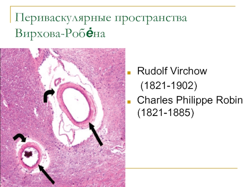 Пространство робина. Пространства Вирхова-Робина. Пространства Вирхова-Робена. Пространства Робина Вихроа. Периваскулярные пространства.