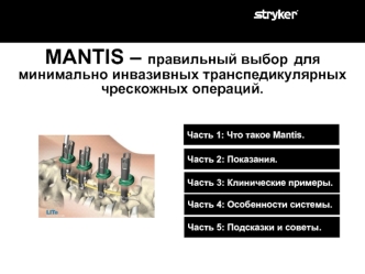 MANTIS – правильный выбор для минимально инвазивных транспедикулярных чрескожных операций.