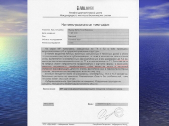 Очаги демиелинизации до начала клеточной терапии.