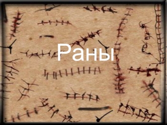 Раны. Основные признаки ран