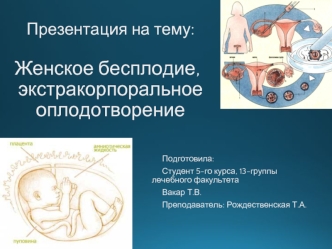 Женское бесплодие, экстракорпоральное оплодотворение