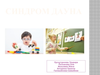 Синдром Дауна