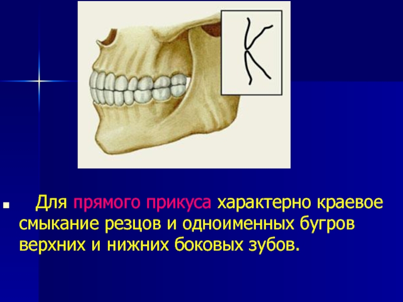 Прямой прикус картинка