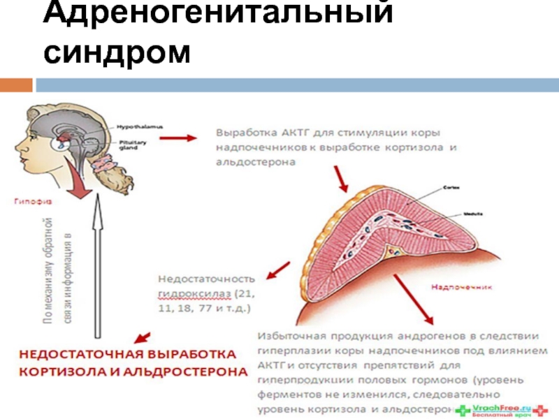 Адреногенитальный синдром презентация