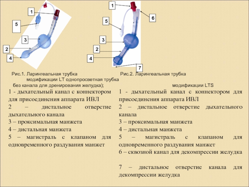 Ларингеальная трубка размеры