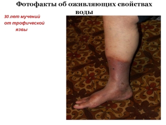 Фотофакты об оживляющих свойствах воды