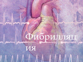 Фибрилляция предсердий