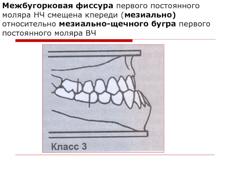 Первые постоянные моляры