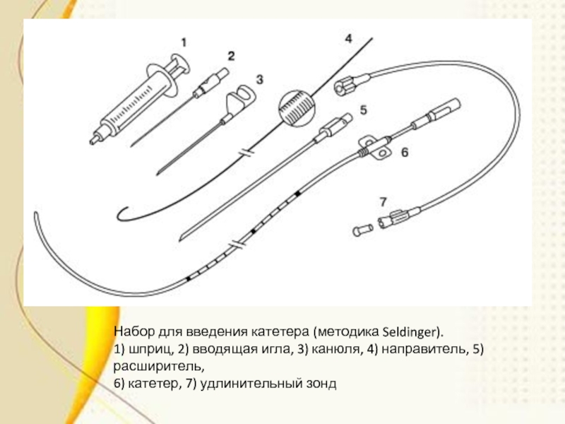 Виды катетеров схема