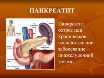 Воспалительное заболевание поджелудочной железы, панкреатит