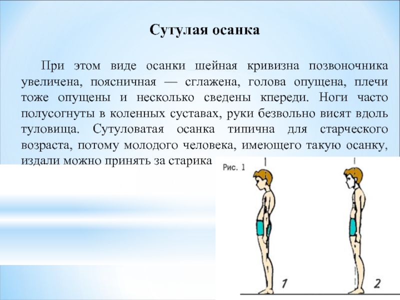 Рассмотрите рисунки 1 4 с изображением типов осанок человека как называют нарушение осанки 4