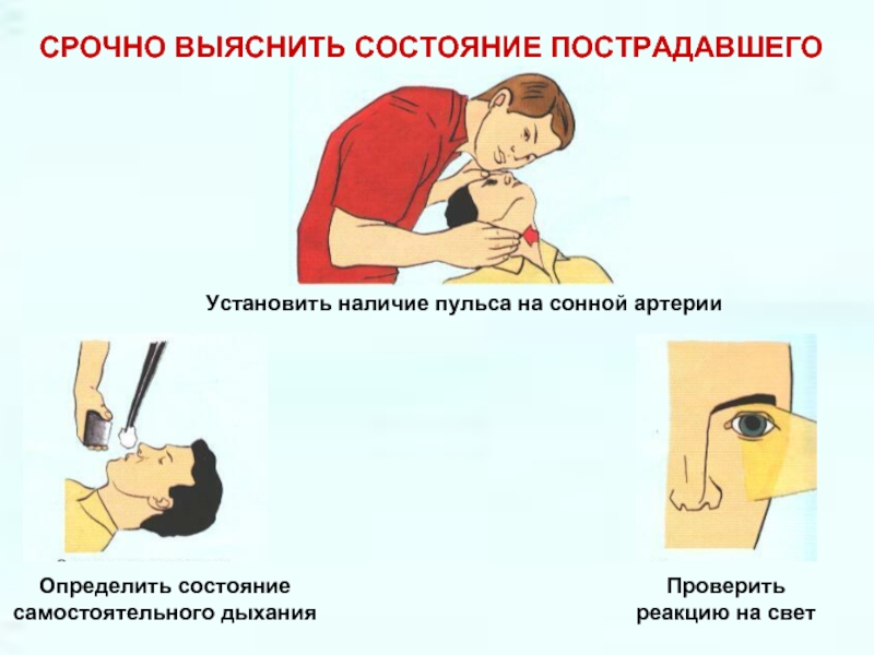 Пульс на сонной артерии. Наличие пульса на сонной артерии пострадавшего. Определить пульс на сонной артерии. Как определить наличие пульса на сонной артерии пострадавшего?. Определить наличие пульса на сонной артерии.