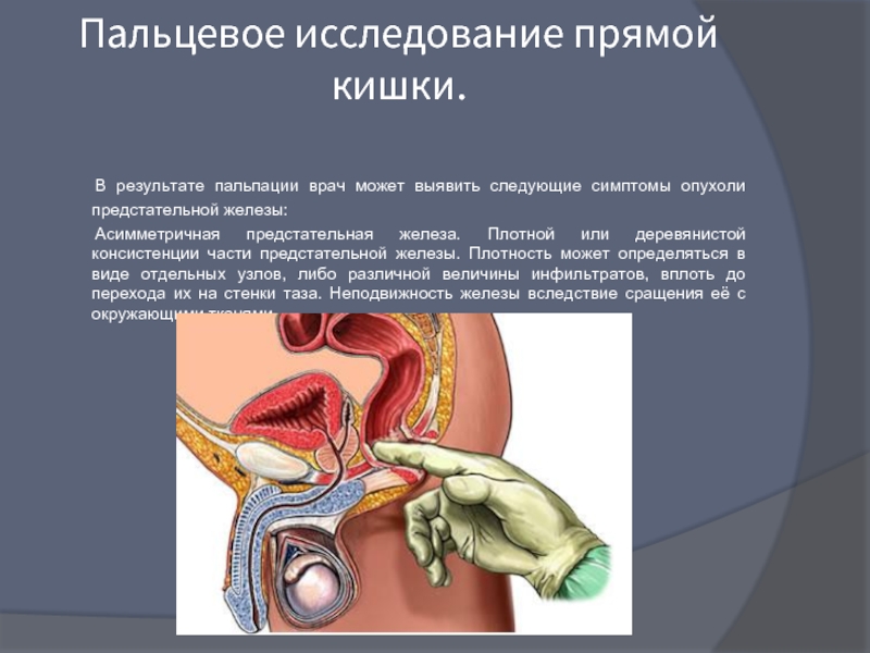 Доклад: Предстательная железа