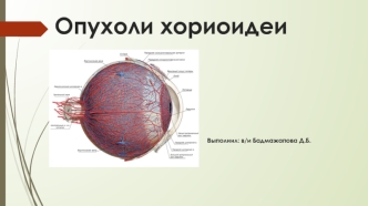 Опухоли хориоидеи