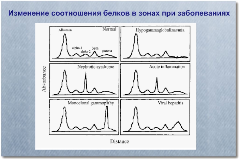 Электрофорез м градиент