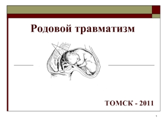 Родовой травматизм