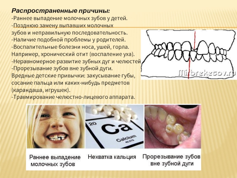 Как у детей выпадают молочные зубы фото