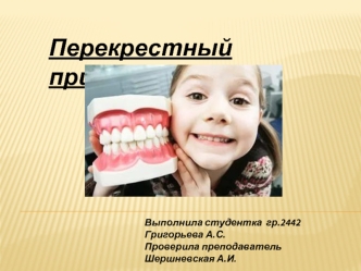 Перекрестный прикус