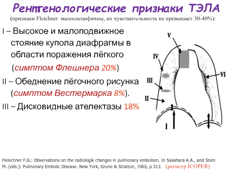 Стояние купола диафрагмы