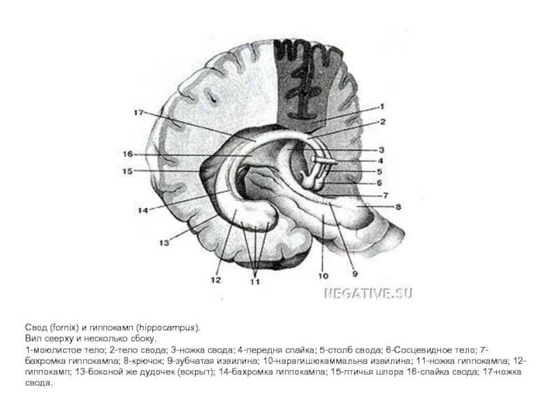 Своды образования 38. Строение свода головного мозга. Мозолистое тело свод передняя спайка анатомия. Свод Fornix. Столбы свода прозрачная перегородка. Свод головного мозга схема.