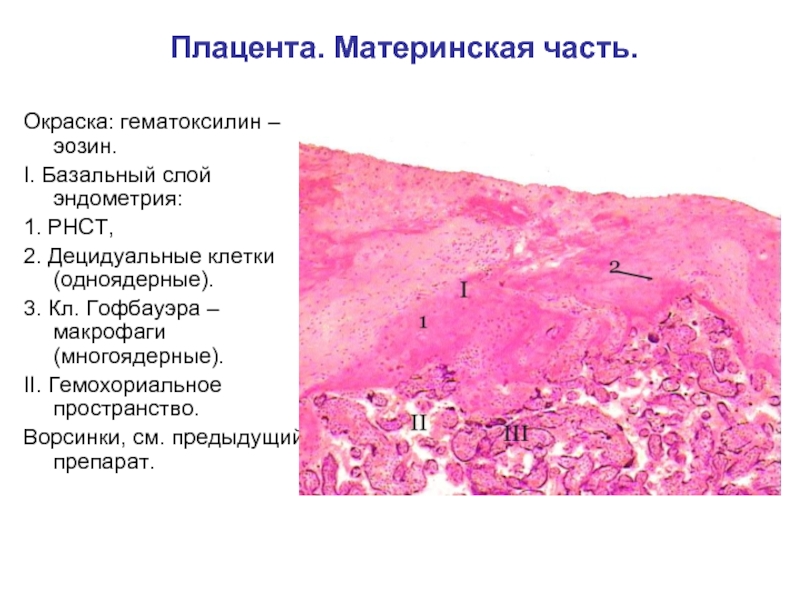 Фрагменты децидуальной ткани