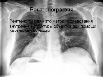 Рентгенография. С какой целью проводится рентгенография. Подготовка к прохождению